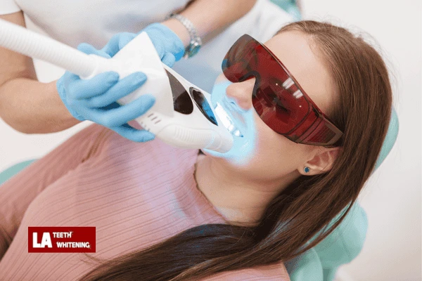 Do You Get Instant Hollywood-White Teeth After One Session Haywards Heath